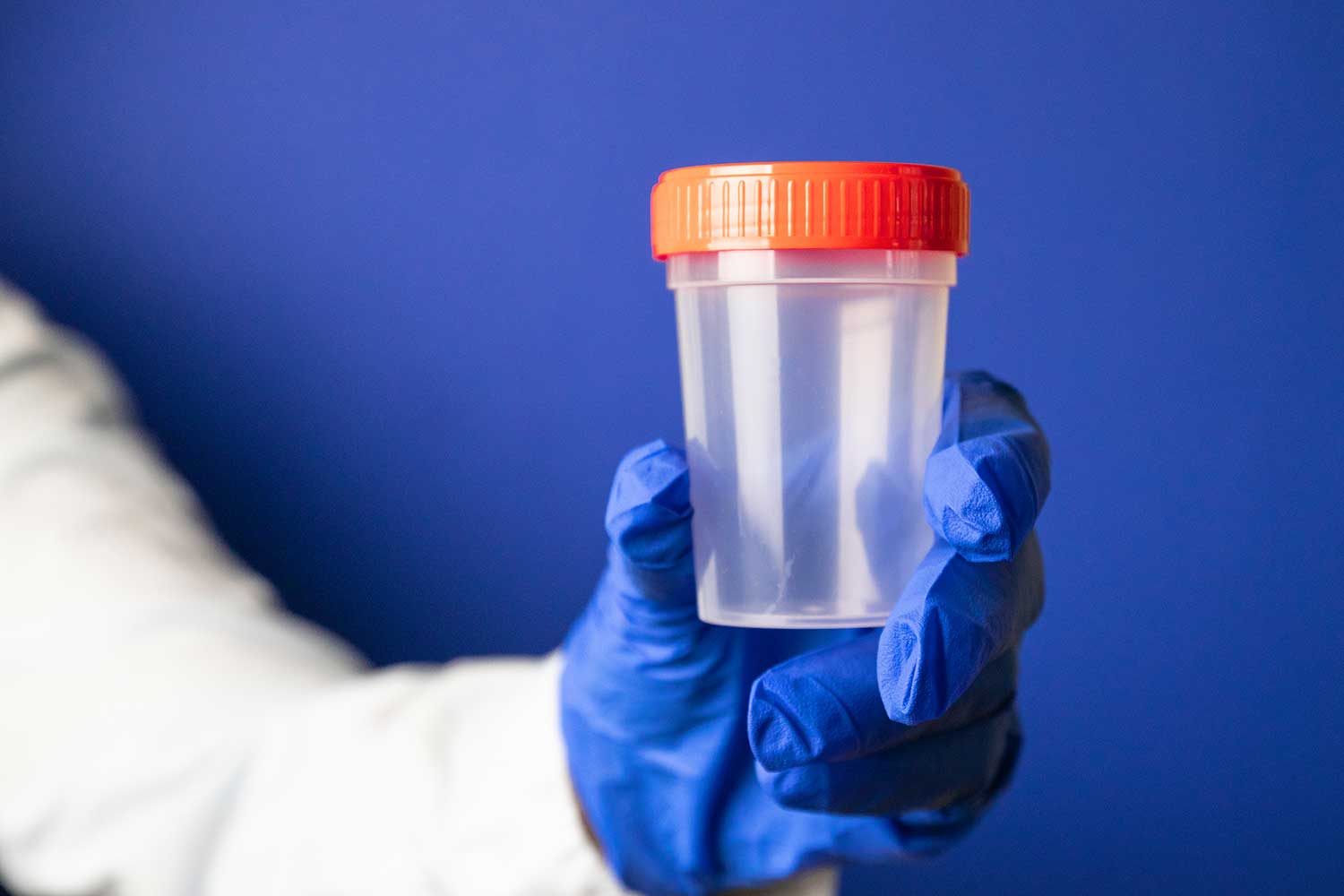 How Long Does Fentanyl Stay in Your System? Guide to Drug Test