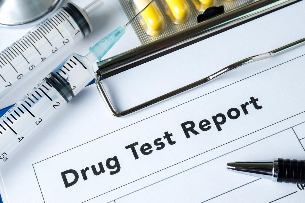 How Long Do Opioids Stay in Your System? Drug Test Facts & Detox