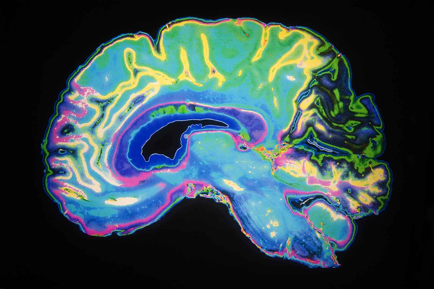 Opiate Receptors and Addiction Information