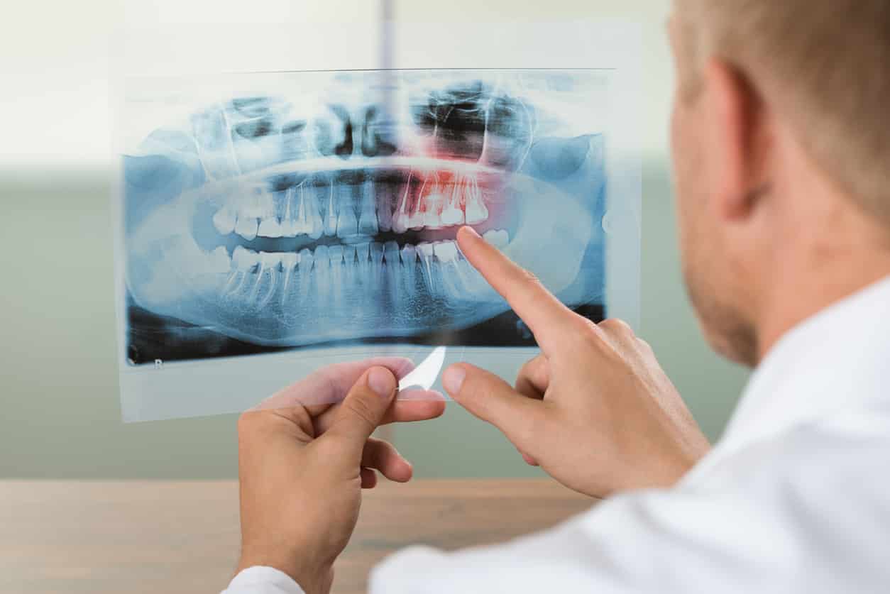 Exploring New Ways to Manage Dental Pain