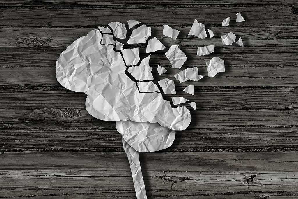 Opioid-Induced Neurotoxicity: A Comprehensive Guide