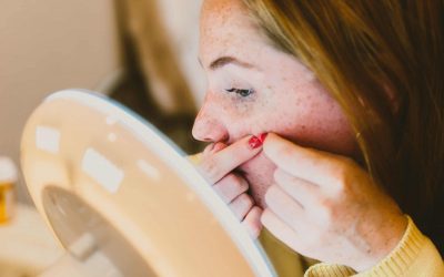 How to Get Rid of Acne with medication and more